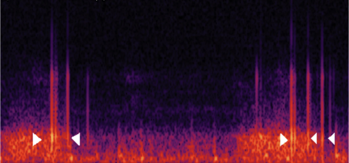 Audio_Lung Sounds with Crackle 1