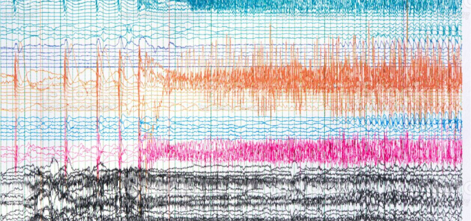 Waveform_EEG2_istockphoto-1319214933-1024x1024 1